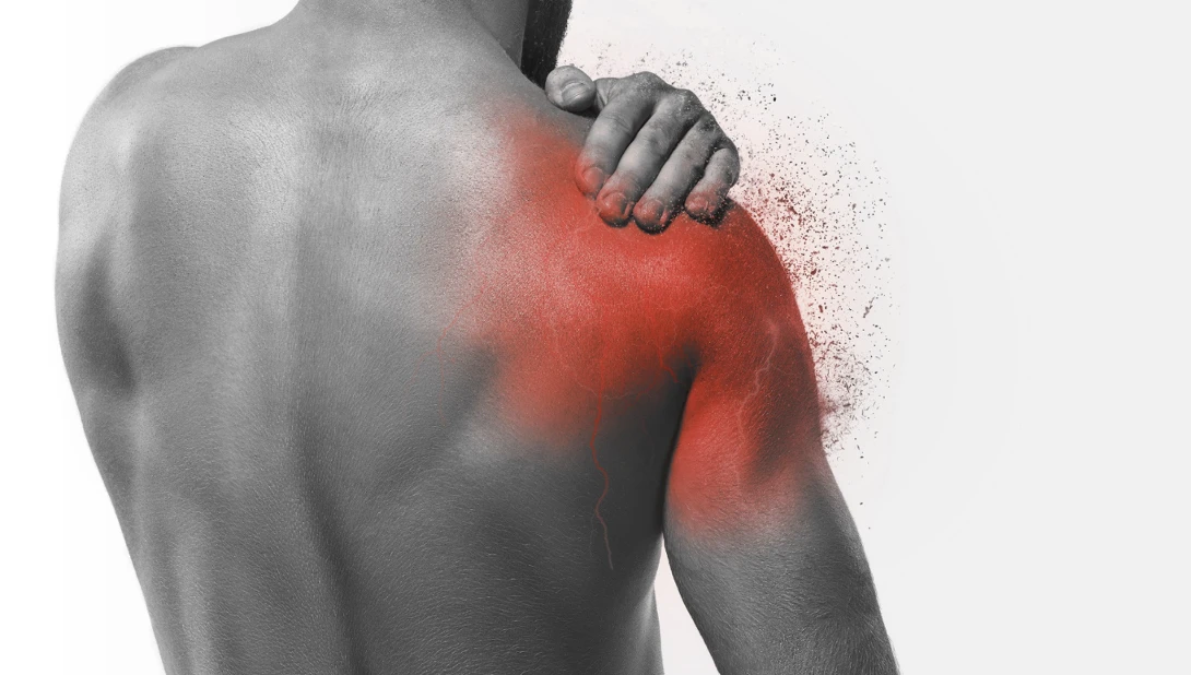 Shoulder Pain and Disability Index (SPADI)