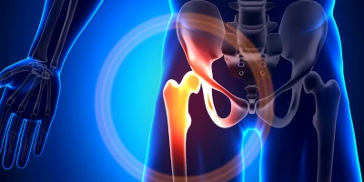 Muscles de la hanche : rôles, biomécanique et implications cliniques
