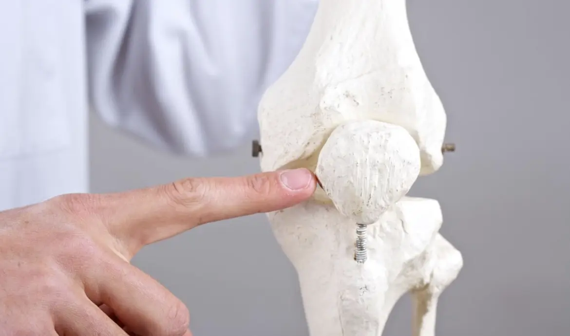 Instabilité fémoro-patellaire : présentation clinique, déterminants anatomo-biomécaniques, évolution et implications thérapeutiques 