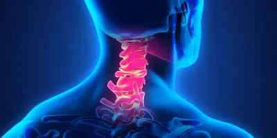 Core Whiplash Outcome Measure (CWOM)