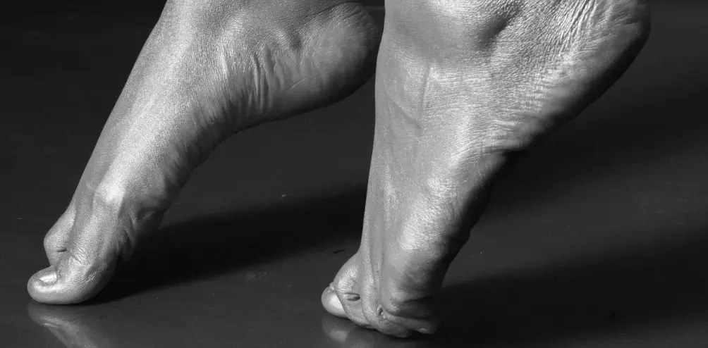 Foot and Ankle Disability Index (FADI) 