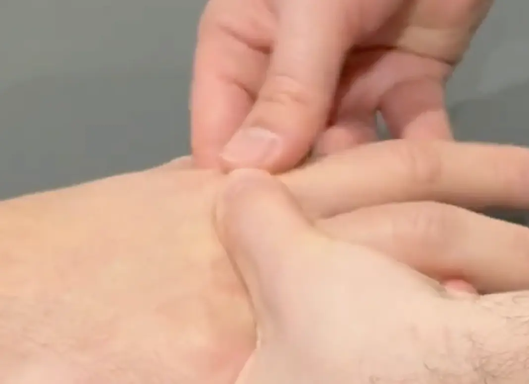 Linscheid Squeeze Test
