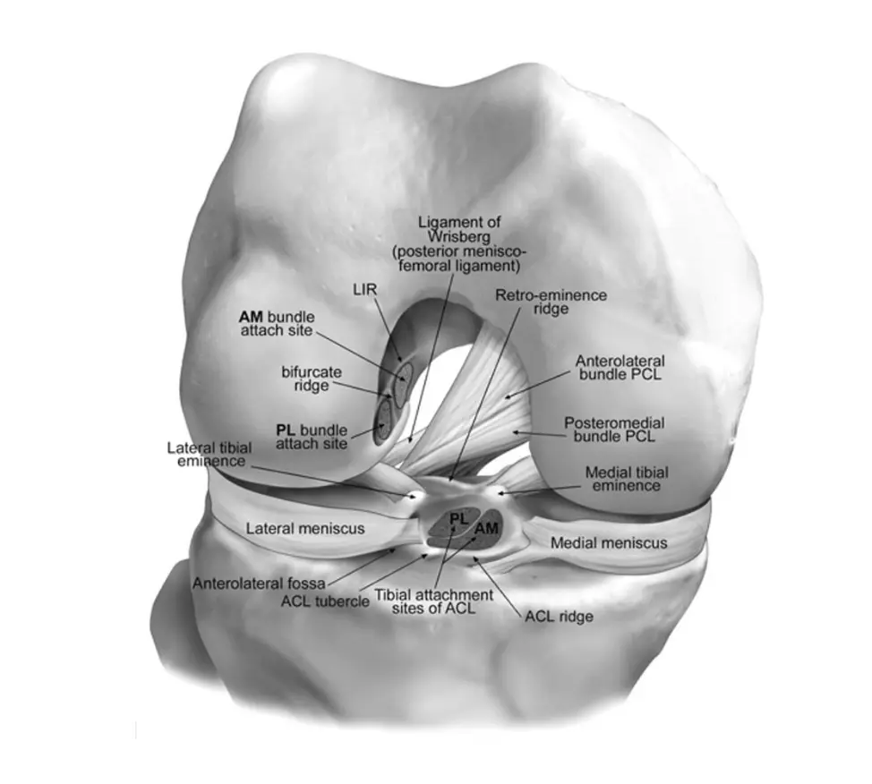 Image Rupture du ligament croisé antérieur : physiopathologie complète, du mécanisme lésionnel à l’arthrose post-traumatique 