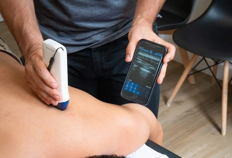 Echographe Ultrasound-Unlimited - Sonde Linéaire AVEC DOPPLER